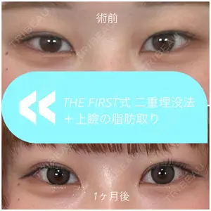 THE FIRST CLINIC 多摩センター院 惟村 公郁医師の症例