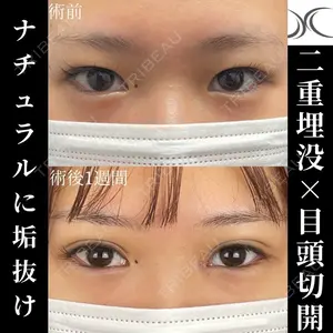 ネビュラクリニック 京都院 岸 大輔医師の症例