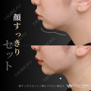 Otus Clinic 【オータスクリニック】 中 徳太郎医師の症例