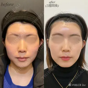 DMTC美容皮膚科 日本橋院 山中大介医師の症例