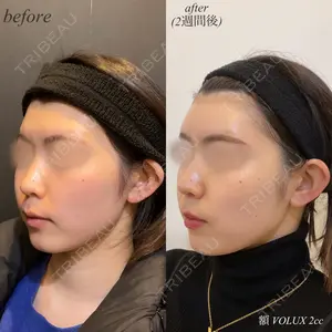 DMTC美容皮膚科 日本橋院 山中大介医師の症例