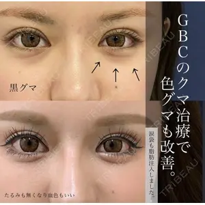 グローバルビューティークリニック 銀座院 理事長　杉崎　裕斗医師の症例