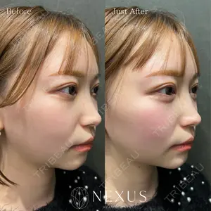 NEXUS CLINIC 渡辺　佳奈医師の症例