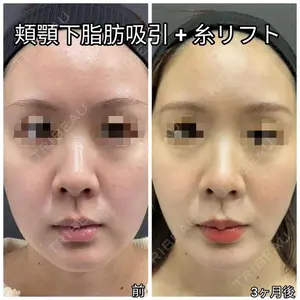 ゆきスキンクリニック 東池袋 小林 智之医師の症例