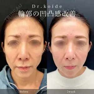 東京シンデレラ美容外科 池袋院の症例