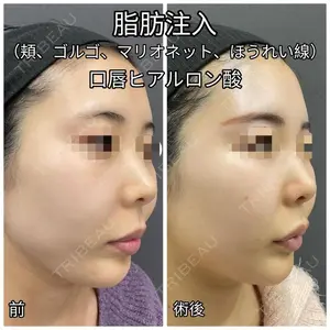 ゆきスキンクリニック 東池袋 小林 智之医師の症例