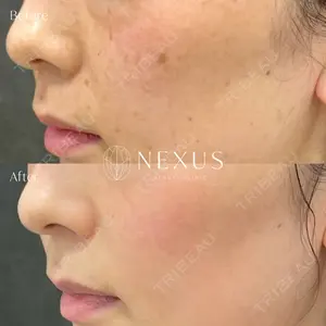 NEXUS CLINICの症例