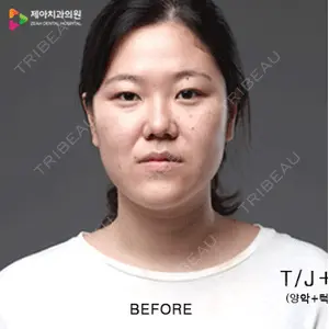 ジェア歯科 カン・ヨンホ医師の症例