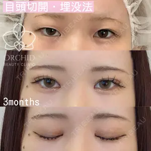 オーキッド美容クリニック東京御徒町 西浦 蘭子医師の症例