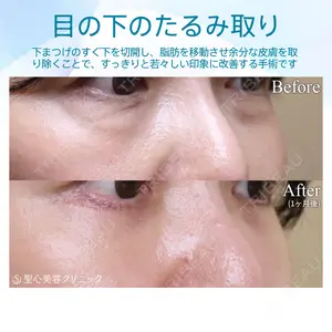 聖心美容クリニック 銀座院 牧野 陽二郎医師の症例