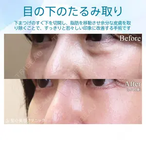 聖心美容クリニック 銀座院 牧野 陽二郎医師の症例