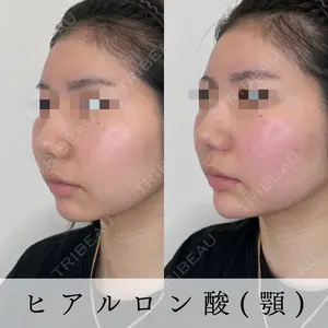 Mavie Beauty Clinic （マヴィービューティークリニック）の症例