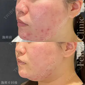 Fellez Clinic【フェルズクリニック】の症例