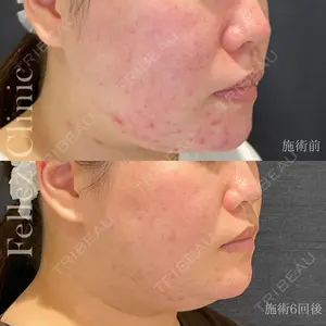 Fellez Clinic【フェルズクリニック】の症例