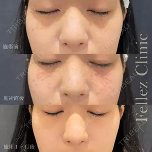 Fellez Clinic【フェルズクリニック】 小野 泰寛医師の症例