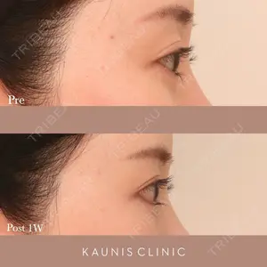 KAUNIS CLINIC（カウニスクリニック） 高野 敏郎医師の症例