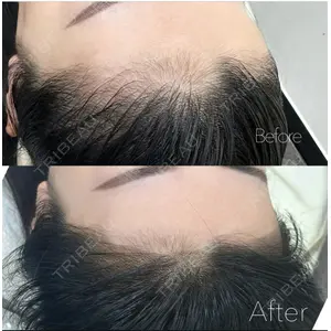 セカジソウォン医院-明洞店の症例