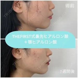 THE FIRST CLINIC 多摩センター院 惟村 公郁医師の症例