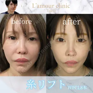 L‘amour clinic Tokyo【ラムールクリニック東京】の症例