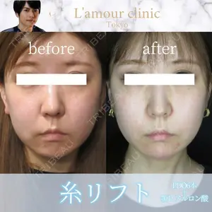 L‘amour clinic Tokyo【ラムールクリニック東京】の症例