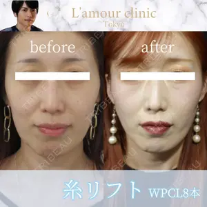 L‘amour clinic Tokyo【ラムールクリニック東京】の症例