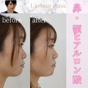 L‘amour clinic Tokyo【ラムールクリニック東京】の症例