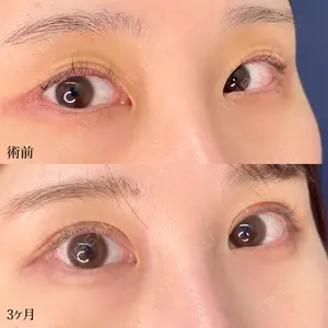東京シンデレラ美容外科 大宮院の症例