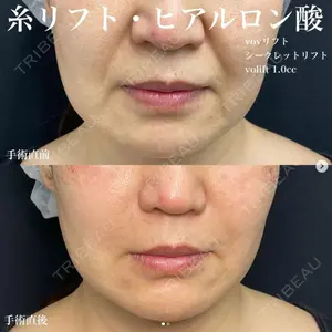 湘南美容クリニック 銀座院の症例