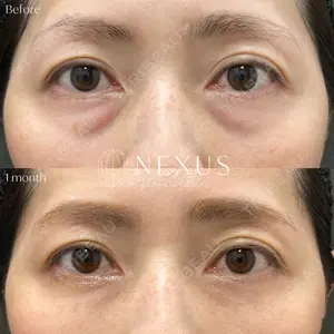 NEXUS CLINICの症例