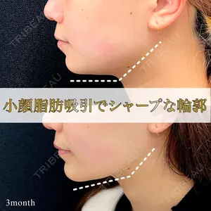 東京シンデレラ美容外科 池袋院の症例