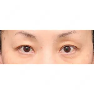 プリモ麻布十番クリニック 大場教弘医師の症例