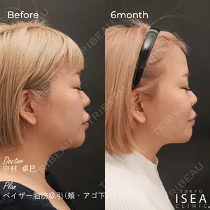 東京イセアクリニックの症例