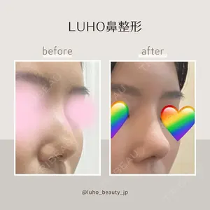 LUHO（ルホ）美容外科の症例