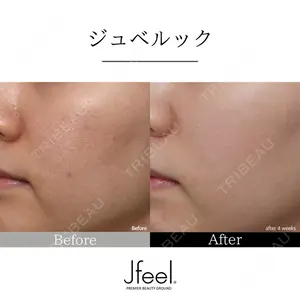 Jfeel（ジェイフィール）クリニック-ホンデ院の症例