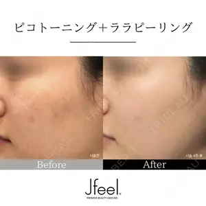 Jfeel（ジェイフィール）クリニック-ホンデ院の症例