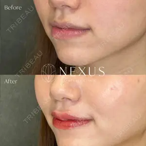 NEXUS CLINICの症例