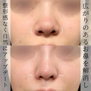 グローバルビューティークリニック 大阪院の症例