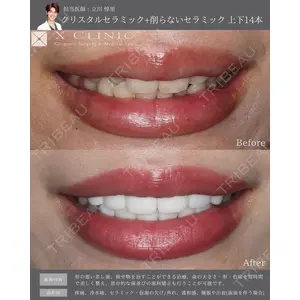 X CLINIC 銀座院 立川 惇里医師の症例