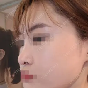 LUHO（ルホ）美容外科 キム・ジュンヨン医師の症例