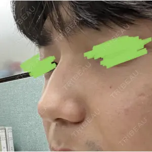 LUHO（ルホ）美容外科 キム・ジュンヨン医師の症例