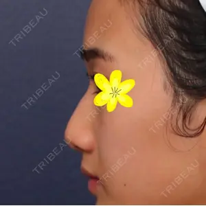 LUHO（ルホ）美容外科 キム・ジュンヨン医師の症例