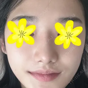 LUHO（ルホ）美容外科 キム・ジュンヨン医師の症例