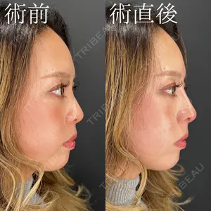 HAAB×DREAM BEAUTY CLINIC 大阪梅田院 柏木 太雅医師の症例