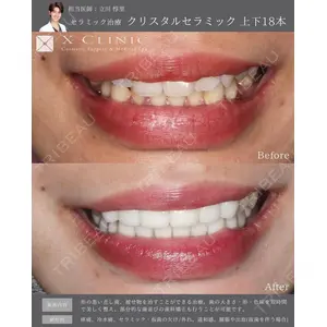 X CLINIC 銀座院 立川 惇里医師の症例
