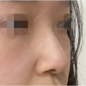 LUHO（ルホ）美容外科 キム・ジュンヨン医師の症例