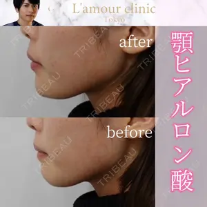 L‘amour clinic Tokyo【ラムールクリニック東京】の症例