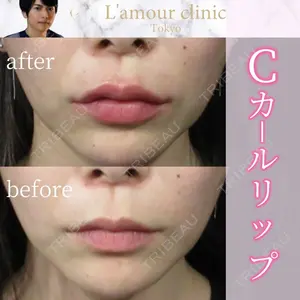 L‘amour clinic Tokyo【ラムールクリニック東京】の症例