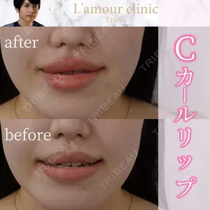 L‘amour clinic Tokyo【ラムールクリニック東京】の症例