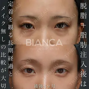 BIANCA銀座 堀田 和亮医師の症例