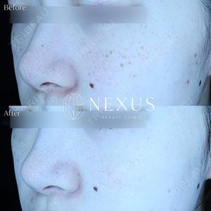 NEXUS CLINICの症例